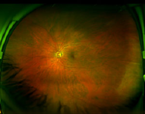 Lisa Radon, 'A picture of the back of my eye (left)' (2016). Image on webpage. Courtesy of the artist.
